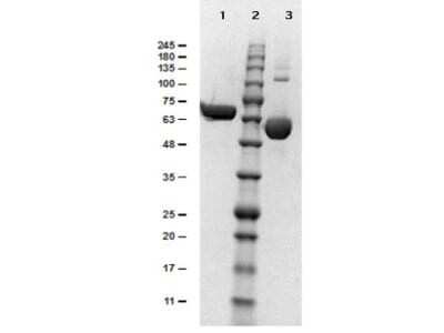 SDS-PAGE: Albumin Native Protein [NBP1-97049]